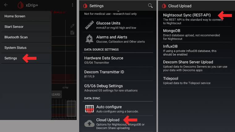 xDrip+ Basic Settings 1